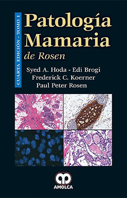 PATOLOGIA MAMARIA DE ROSEN 2T