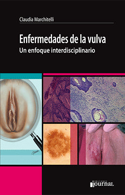 ENFERMEDADES DE LA VULVA UN ENFOQUE INTERDISCIPLINARIO
