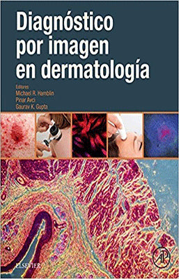 DIAGNOSTICO POR IMAGEN EN DERMATOLOGIA