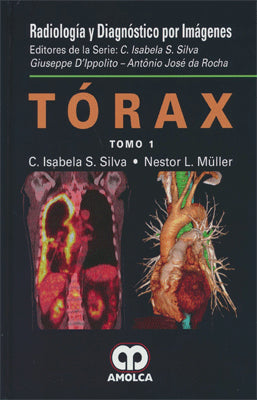 RADIOLOGIA Y DIAGNOSTICO POR IMAGEN TORAX