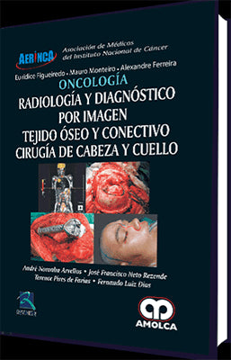 ONCOLOGIA RADIOLOGIA Y DIAGNOSTICO POR IMAGEN TEJIDO OSEO Y CONECTIVO CIRUGIA DE CABEZA Y CUELLO