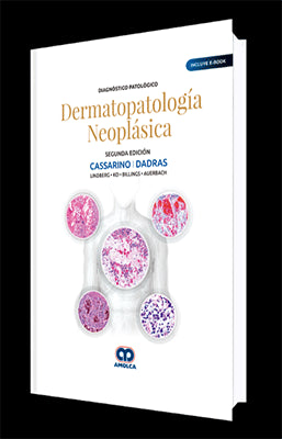 DIAGNOSTICO PATOLOGICO DERMATOPATOLOGIA NEOPLASIA