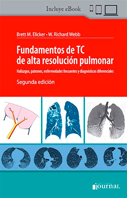 FUNDAMENTOS DE TC DE ALTA RESOLUCION PULMONAR 2ED