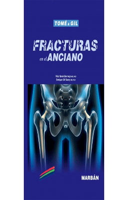 FRACTURAS EN EL ANCIANO