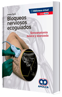 BLOQUEO DE NERVIOS ECOGUIADOS