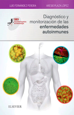 DIAGNOSTICO Y MONITORIZACION DE LAS ENFERMEDADES AUTOINMUNES
