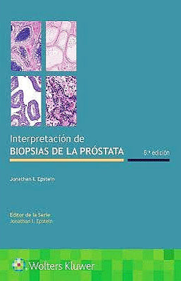 INTERPRETACION DE BIOPSIAS DE LA PROSTATA 6ED