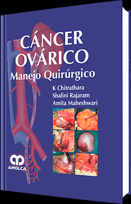 CARCER OVARICO MANEJO QUIRURGICO