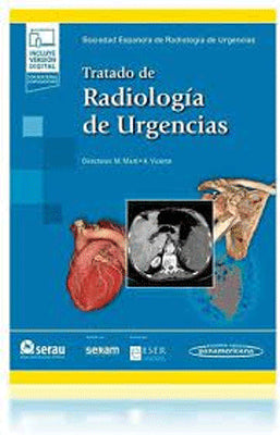 TRATADO DE RADIOLOGIA DE URGENCIAS
