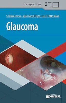 GLAUCOMA