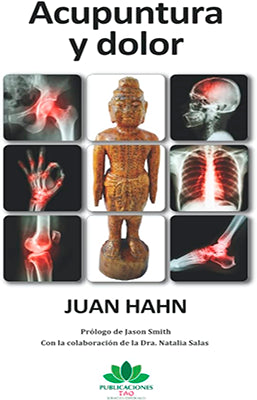 ACUPUNTURA Y DOLOR