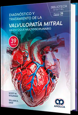 DIAGNOSTICO Y TRATAMIENTO DE LA VALVULOPATIA MITRAL