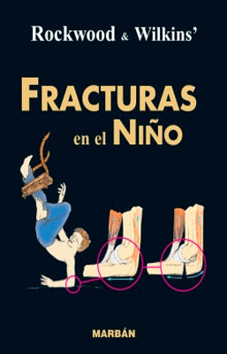 FRACTURAS EN EL NIÑO