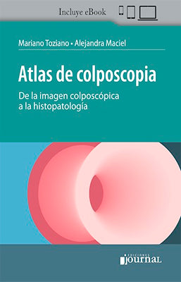 ATLAS DE COLPOSCOPIA