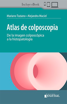 ATLAS DE COLPOSCOPIA