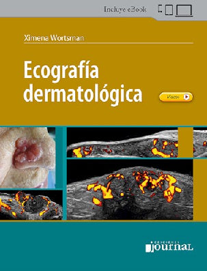 ECOGRAFIA DERMATOLOGICA