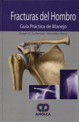 FRACTURAS DEL HOMBRO