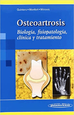 OSTEOARTROSIS BIOLOGIA, FISIOPATOLOGIA CLINICA Y TRATAMIENTO