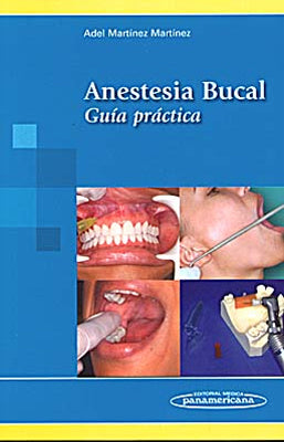 ANESTESIA BUCAL GUIA PRACTICA