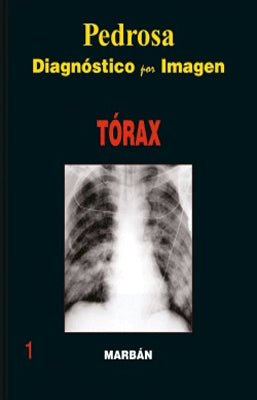 Nº1 DIAGNOSTICO POR IMAGEN TORAX
