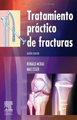 TRATAMIENTO PRACTICO DE FRACTURAS