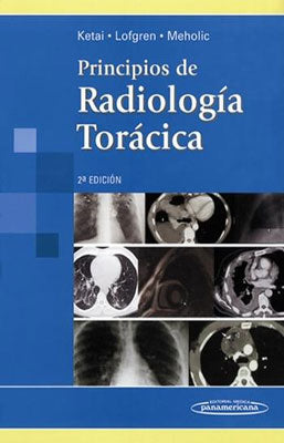 PRIMCIPIOS DE RADIOLOGIA TORACICA