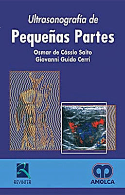 ULTRASONOGRAFIA DE PEQUEÑAS PARTES