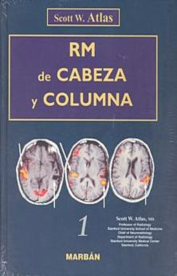RM DE CABEZA Y COLUMNA