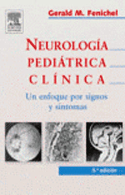 NEUROLOGIA PEDIATRICA CLINICA UN ENFOQUE POR SIGNOS Y SINTOMAS