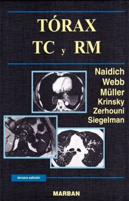 TORAX TC Y RM