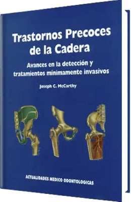 TRANSTORNOS PRECOCES DE LA CADERA