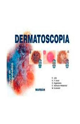 DERMATOSCOPIA PAUTAS DE DIAGNOSTICO