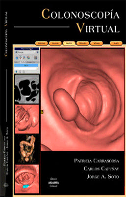 HISTEROSALPINGOGRAFIA VIRTUAL + CD