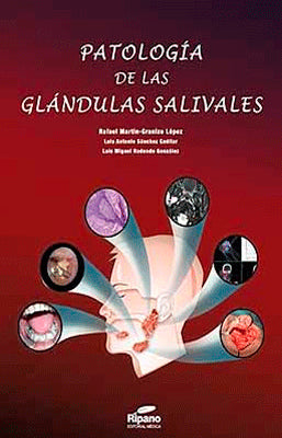 PATOLOGIA DE LAS GLANDULAS SALIVALES