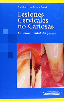 LESIONES CERVICALES NO CARIOSAS