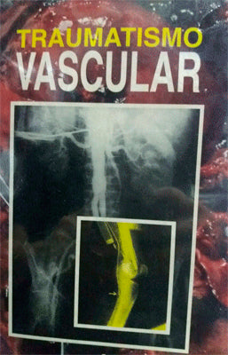 TRAUMATISMO VASCULAR