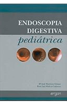 ENDOSCOPIA DIGESTIVA PEDIATRICA