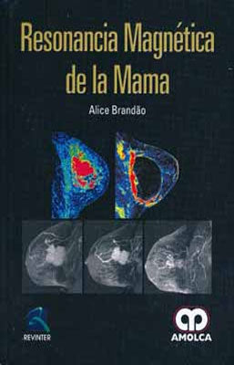 RESONANCIA MAGNETICA DE LA MAMA
