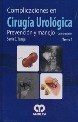 COMPLICACIONES EN CIRUGIA UROLOGICA PREVENCION Y MANEJO