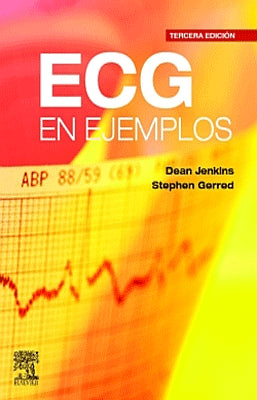 ECG EN EJEMPLOS
