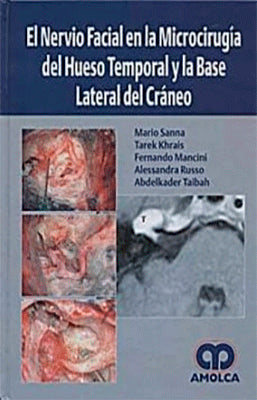 EL NERVIO FACIAL EN LA MICROCIRUGIA DEL HUESO TEMPORAL Y LA BASE LATERAL DEL CRANEO