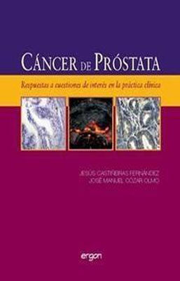 CANCER DE PROSTATA RESPUESTAS A CUESTIONES DE INTERES EN LA PRACTICA CLINICA