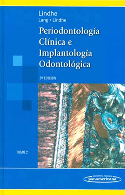 PERIODONTOLOGIA CLINICA E IMPLANTOLOGIA ODONTOLOGICA TOMO II