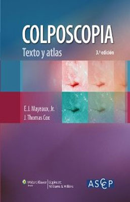 COLPOSCOPIA TEXTO Y ATLAS