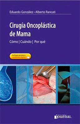 CIRUGIA ONCOPLASTICA DE MAMA
