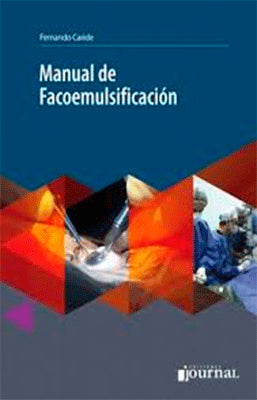 MANUAL DE FACOEMULSIFICACION