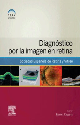 DIAGNOSTICO POR LA IMAGEN EN RETINA