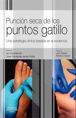 PUNCION SECA DE LOS PUNTOS GATILLO