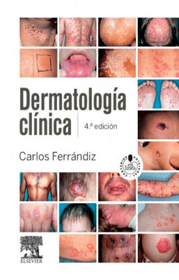 DERMATOLOGIA CLINICA + STUDENTCONSULT EN ESPAÑOL
