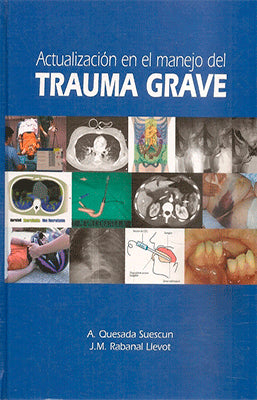 ACTUALIZACION EL EL MANEJO DEL TRAUMA GRAVE